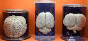 human, rhino and dolphin brains